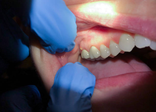 Best Emergency TMJ Treatment in Bellville, TX
